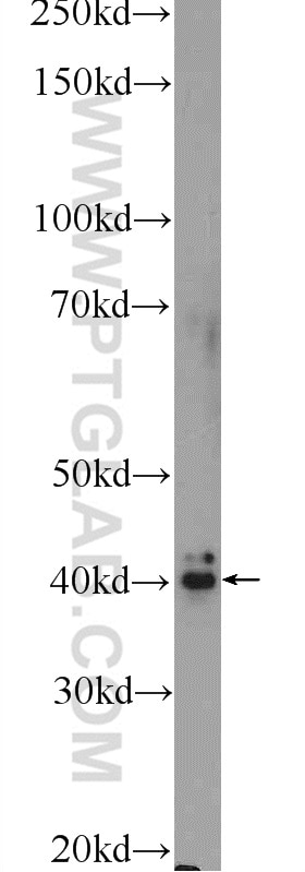 Western Blot (WB) analysis of human plasma using FREM1 Polyclonal antibody (13086-1-AP)