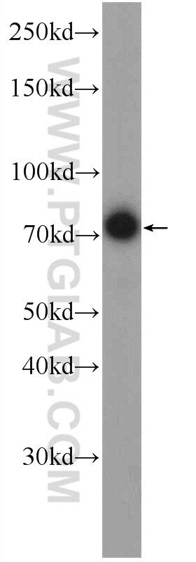 Western Blot (WB) analysis of HepG2 cells using FREM1 Polyclonal antibody (13086-1-AP)