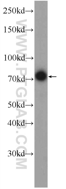 Western Blot (WB) analysis of HepG2 cells using FREM1 Polyclonal antibody (13086-1-AP)