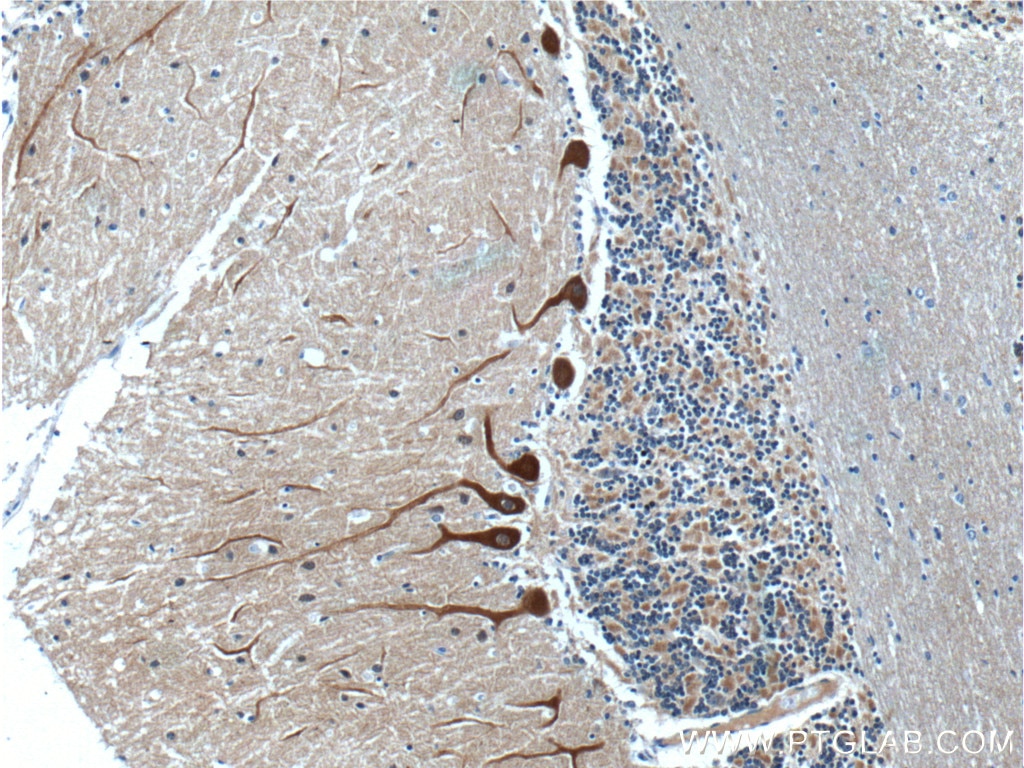 Immunohistochemistry (IHC) staining of human cerebellum tissue using NCS1 Polyclonal antibody (10506-2-AP)