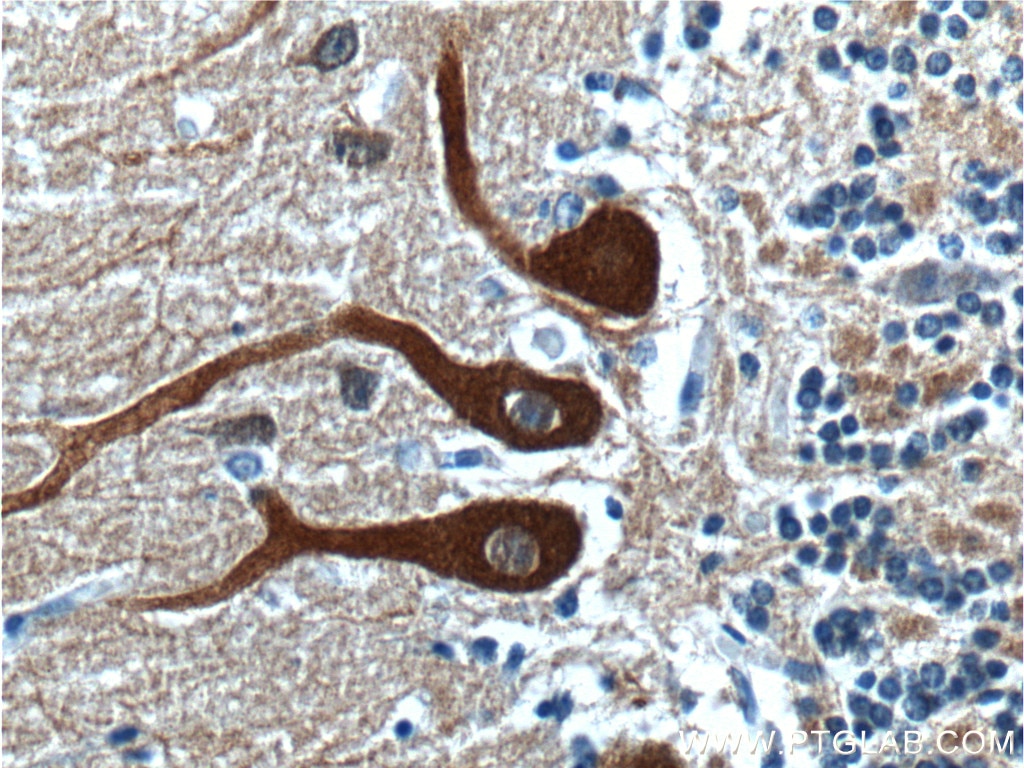 Immunohistochemistry (IHC) staining of human cerebellum tissue using NCS1 Polyclonal antibody (10506-2-AP)