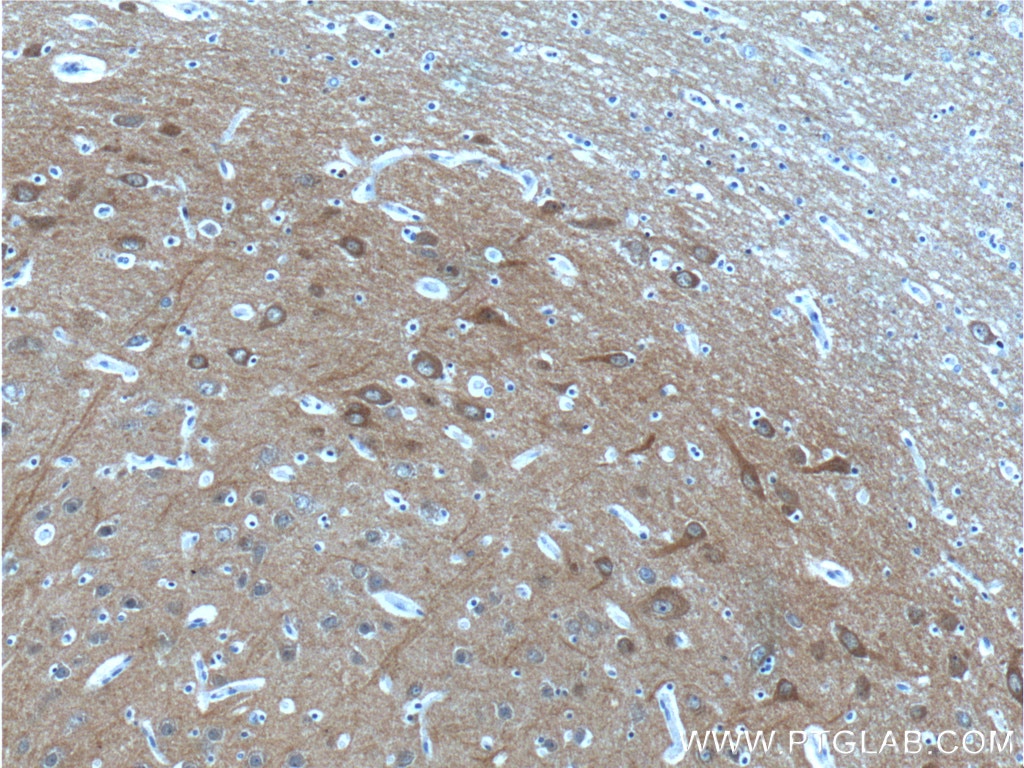 Immunohistochemistry (IHC) staining of human brain tissue using NCS1 Polyclonal antibody (10506-2-AP)