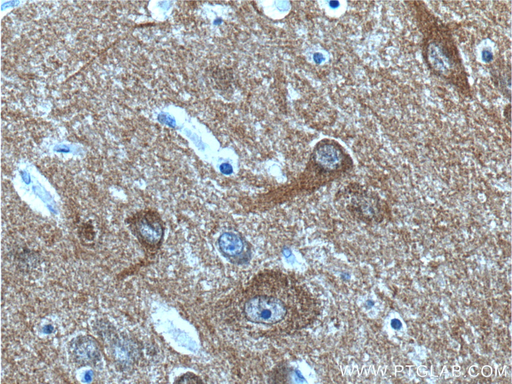 Immunohistochemistry (IHC) staining of human brain tissue using NCS1 Polyclonal antibody (10506-2-AP)