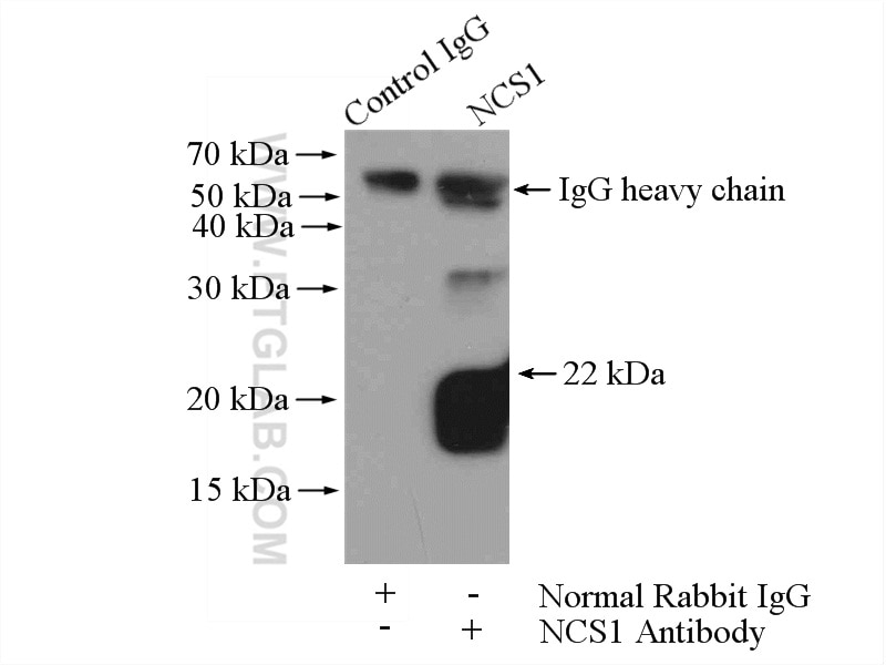 Immunoprecipitation (IP) experiment of mouse brain tissue using NCS1 Polyclonal antibody (10506-2-AP)