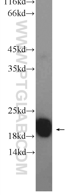 Western Blot (WB) analysis of mouse brain tissue using NCS1 Polyclonal antibody (10506-2-AP)