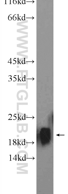 Western Blot (WB) analysis of rat brain tissue using NCS1 Polyclonal antibody (10506-2-AP)