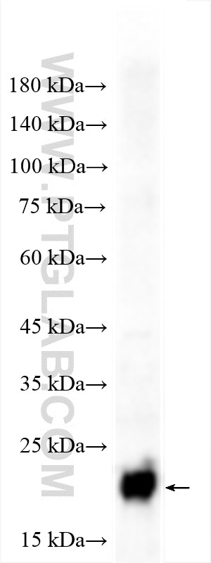 mouse brain tissue were subjected to SDS PAGE followed by western blot with 10506-2-AP (NCS1 antibody) at dilution of 1:4000 incubated at room temperature for 1.5 hours. Western Blot (WB) analysis of mouse brain tissue using NCS1 Polyclonal antibody (10506-2-AP)