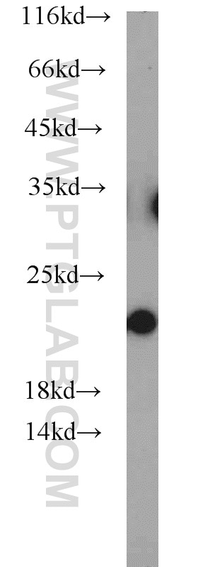 Western Blot (WB) analysis of PC-3 cells using NCS1 Polyclonal antibody (10506-2-AP)