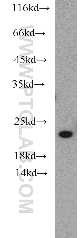 Western Blot (WB) analysis of SH-SY5Y cells using NCS1 Polyclonal antibody (10506-2-AP)