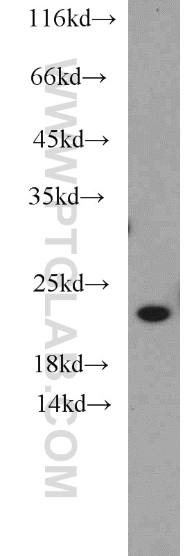 WB analysis of SH-SY5Y using 10506-2-AP