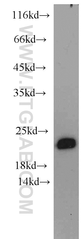 Western Blot (WB) analysis of human brain tissue using NCS1 Polyclonal antibody (10506-2-AP)