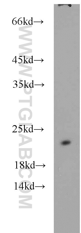 Western Blot (WB) analysis of A431 cells using NCS1 Polyclonal antibody (10506-2-AP)
