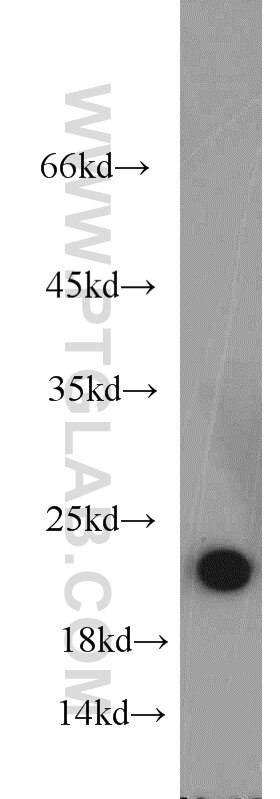 Western Blot (WB) analysis of mouse cerebellum tissue using NCS1 Polyclonal antibody (10506-2-AP)