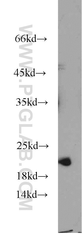Western Blot (WB) analysis of HepG2 cells using NCS1 Polyclonal antibody (10506-2-AP)