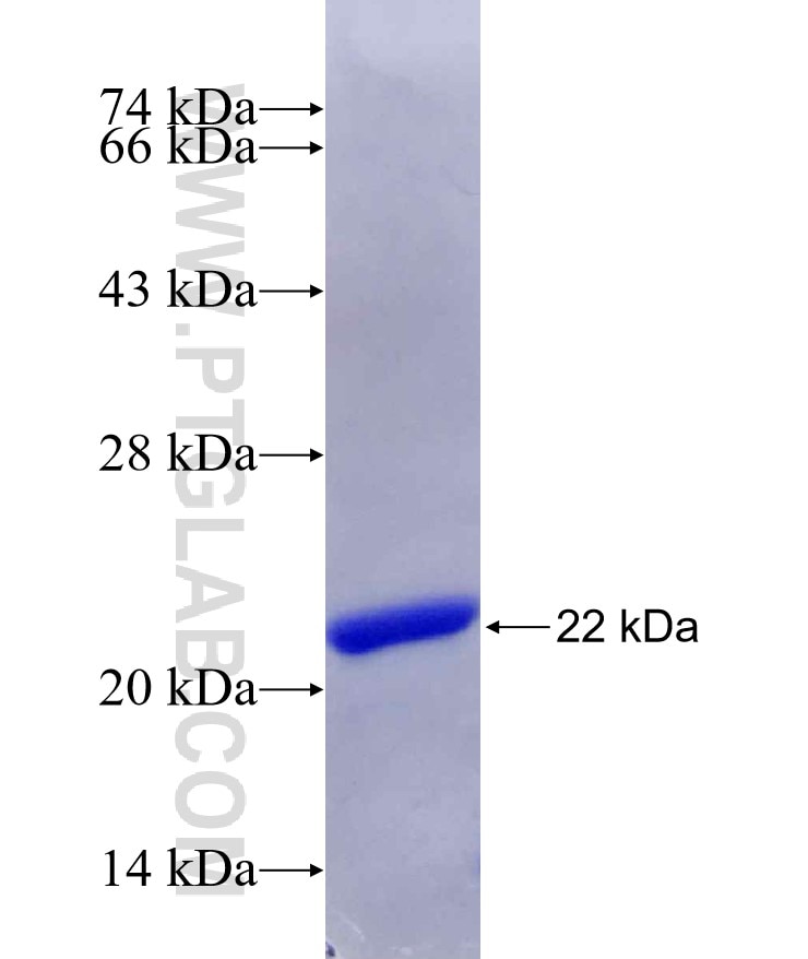 FREQ fusion protein Ag29808 SDS-PAGE