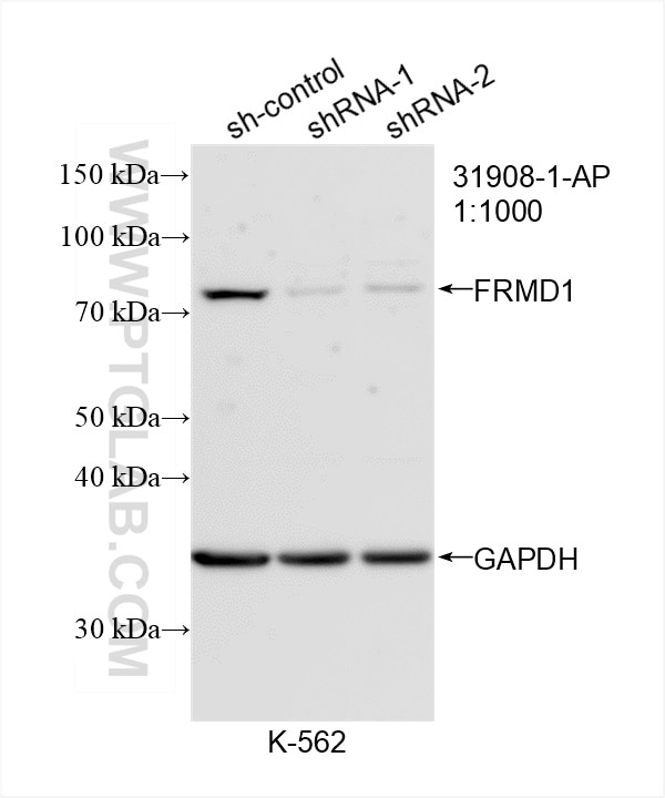 Western Blot (WB) analysis of K-562 cells using FRMD1 Polyclonal antibody (31908-1-AP)