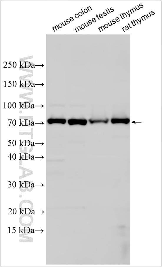 Western Blot (WB) analysis of various lysates using FRMD1 Polyclonal antibody (31908-1-AP)