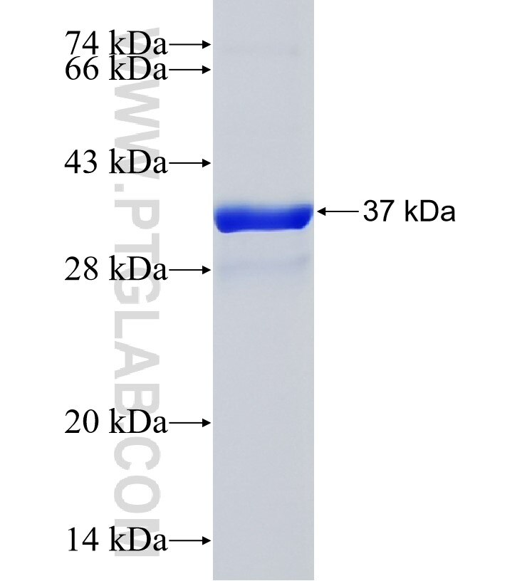 FRMD1 fusion protein Ag36382 SDS-PAGE