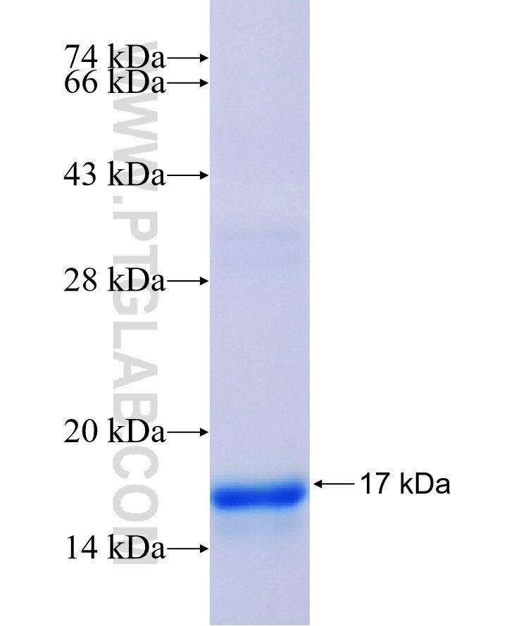FRMD1 fusion protein Ag36443 SDS-PAGE FRMD1 fusion protein Ag36443 SDS-PAGE