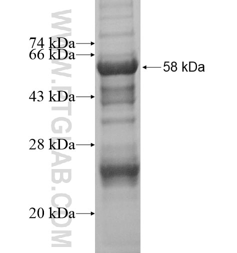 FRMD5 fusion protein Ag14681 SDS-PAGE