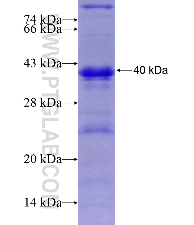 Willin fusion protein Ag17038 SDS-PAGE