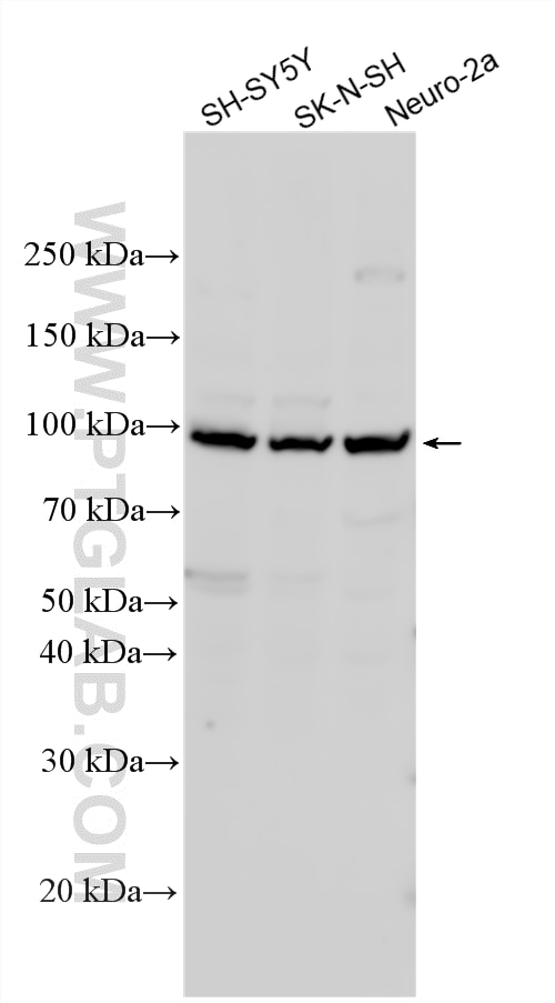 Western Blot (WB) analysis of various lysates using FRMD7 Polyclonal antibody (25033-1-AP)