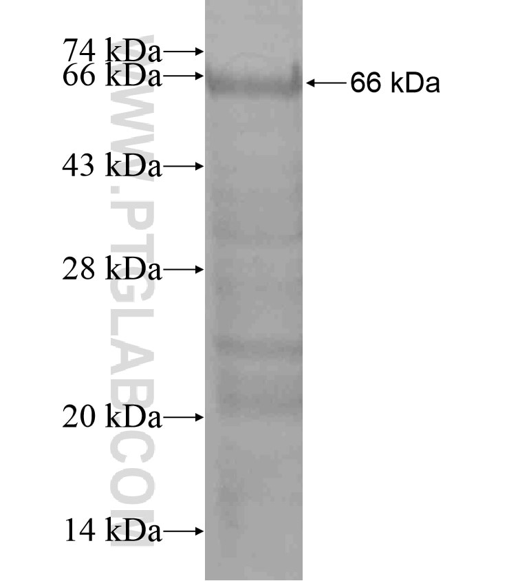 FRMPD1 fusion protein Ag18139 SDS-PAGE