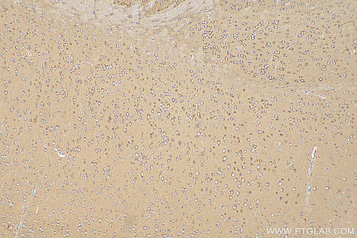 Immunohistochemistry (IHC) staining of mouse brain tissue using FRMPD3 Polyclonal antibody (31635-1-AP)