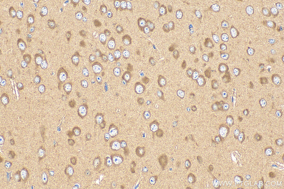 Immunohistochemistry (IHC) staining of mouse brain tissue using FRMPD3 Polyclonal antibody (31635-1-AP)