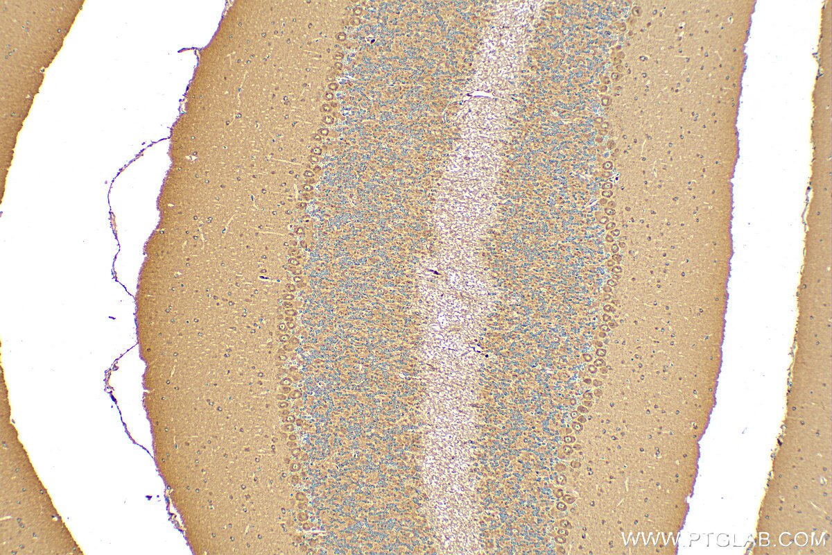 Immunohistochemistry (IHC) staining of mouse cerebellum tissue using FRMPD3 Polyclonal antibody (31635-1-AP)