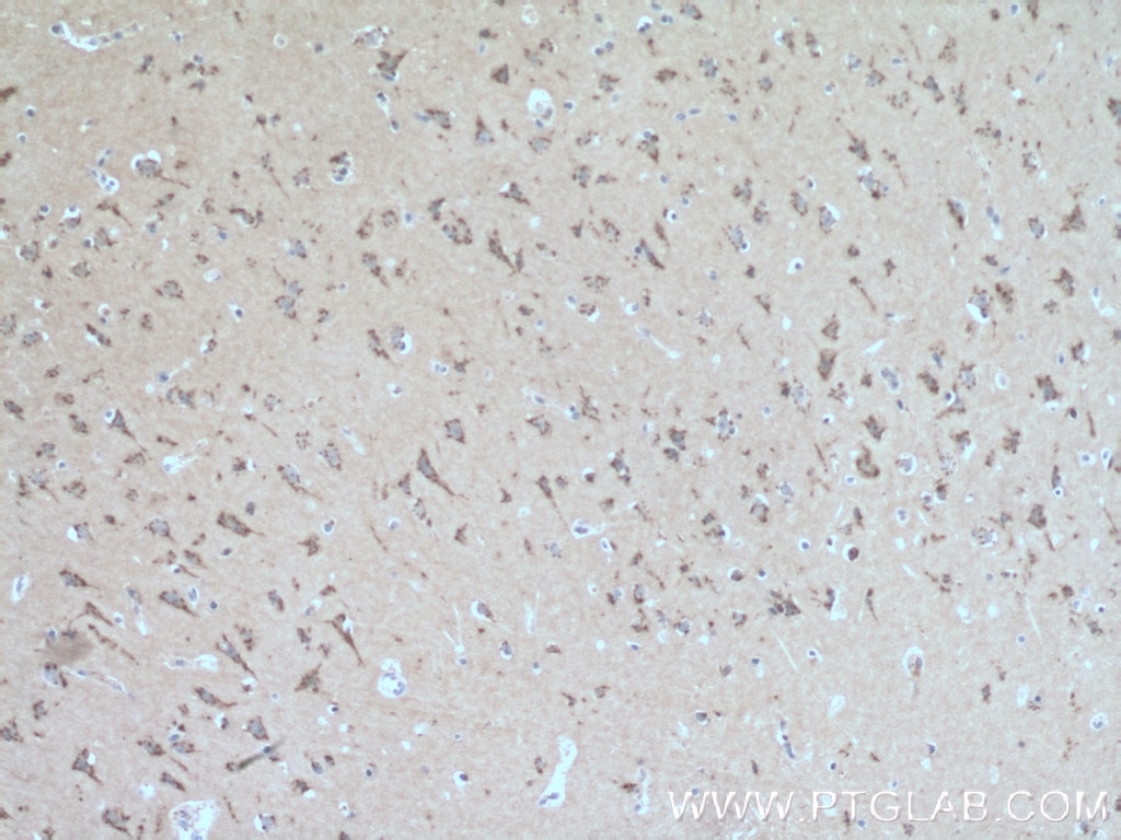 Immunohistochemistry (IHC) staining of human brain tissue using FRMPD4 Polyclonal antibody (23943-1-AP)