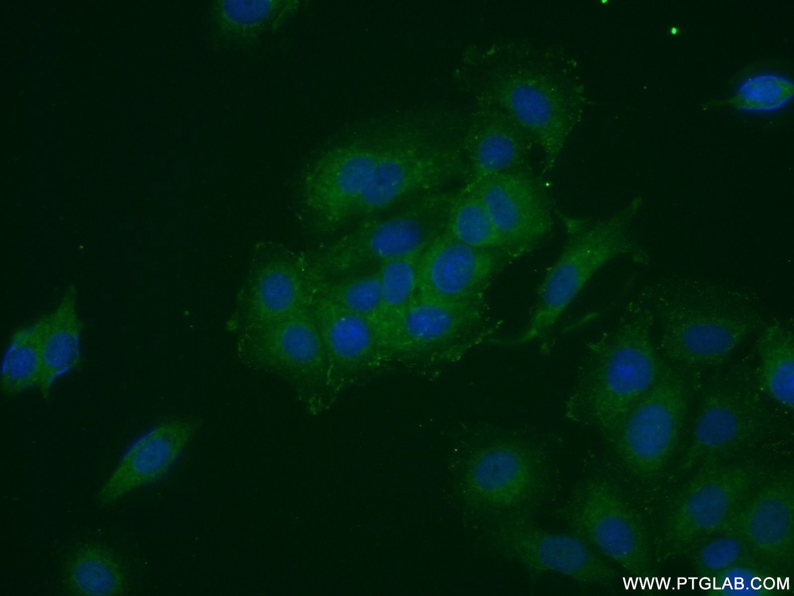 Immunofluorescence (IF) / fluorescent staining of MCF-7 cells using FRS2 Polyclonal antibody (11503-1-AP)