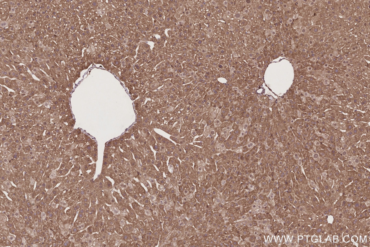Immunohistochemistry (IHC) staining of mouse liver tissue using FRS2 Polyclonal antibody (11503-1-AP)