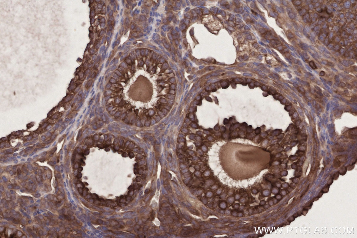 Immunohistochemistry (IHC) staining of mouse ovary tissue using FRS2 Polyclonal antibody (11503-1-AP)