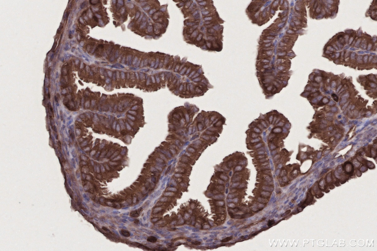 Immunohistochemistry (IHC) staining of mouse ovary tissue using FRS2 Polyclonal antibody (11503-1-AP)