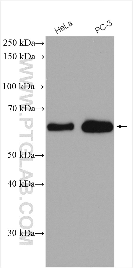 Western Blot (WB) analysis of various lysates using FRS2 Polyclonal antibody (11503-1-AP)