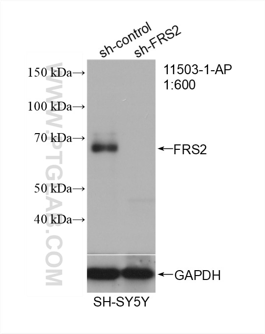 Western Blot (WB) analysis of SH-SY5Y cells using FRS2 Polyclonal antibody (11503-1-AP)