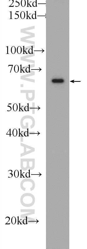 FRS2 Polyclonal antibody