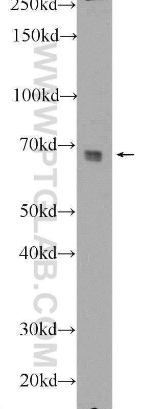 Western Blot (WB) analysis of NIH/3T3 cells using FRS2 Polyclonal antibody (11503-1-AP)