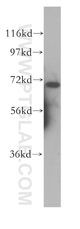 Western Blot (WB) analysis of human brain tissue using FRS2 Polyclonal antibody (11503-1-AP)