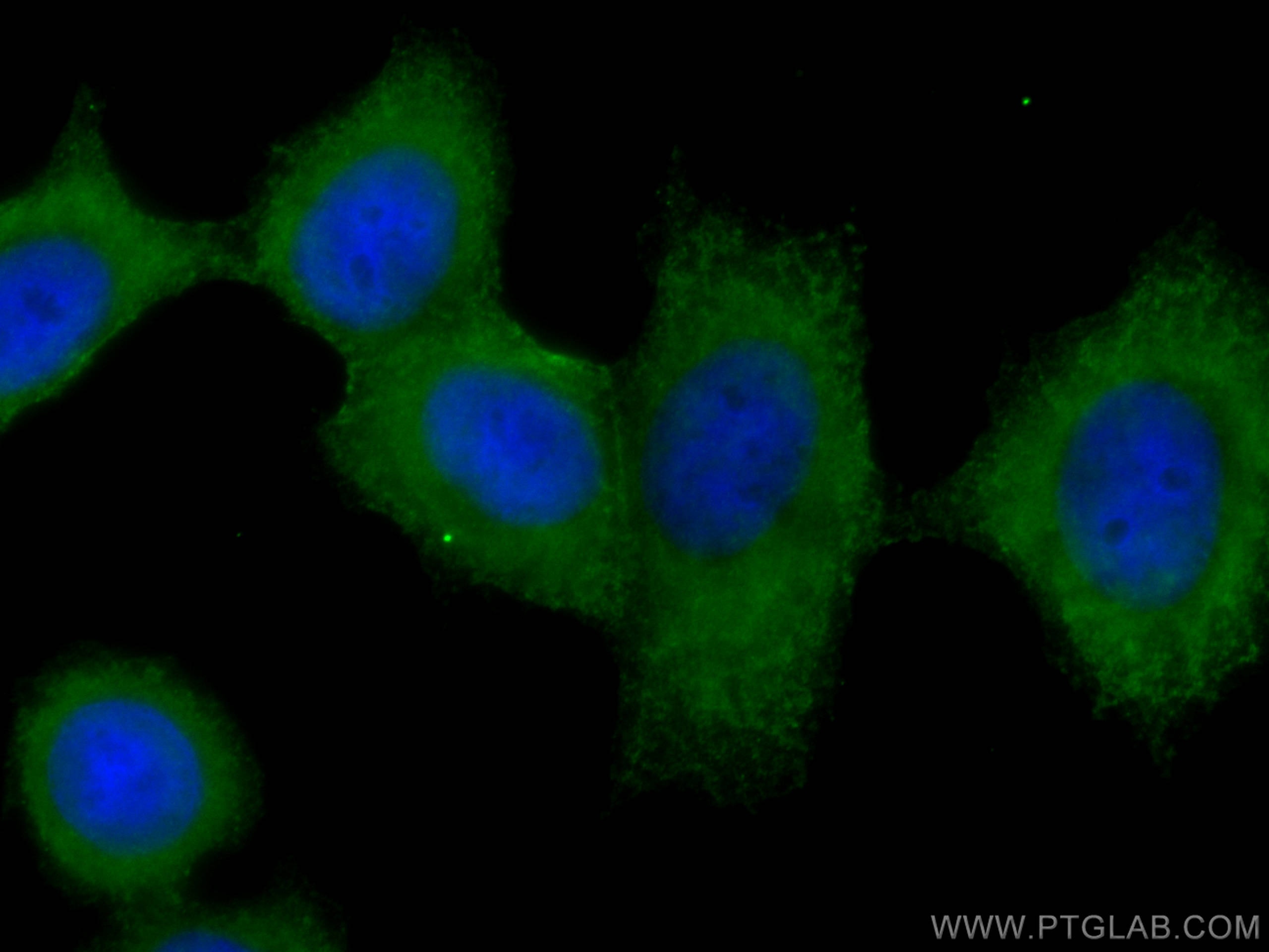 Immunofluorescence (IF) / fluorescent staining of MCF-7 cells using FRS2 Monoclonal antibody (66263-1-Ig)