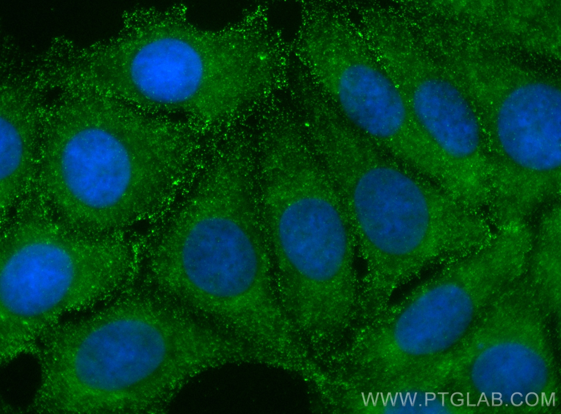Immunofluorescence (IF) / fluorescent staining of MCF-7 cells using FRS2 Monoclonal antibody (66263-1-Ig)