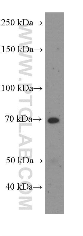 Western Blot (WB) analysis of MCF-7 cells using FRS2 Monoclonal antibody (66263-1-Ig)