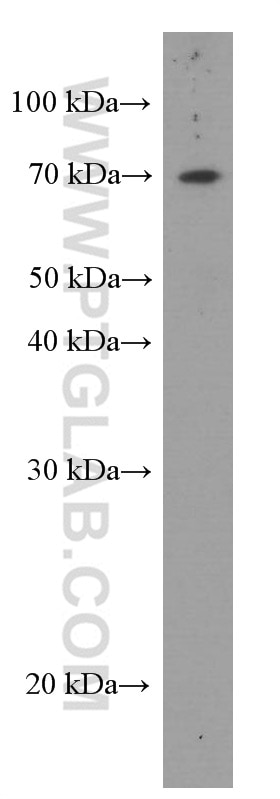 Western Blot (WB) analysis of HeLa cells using FRS2 Monoclonal antibody (66263-1-Ig)