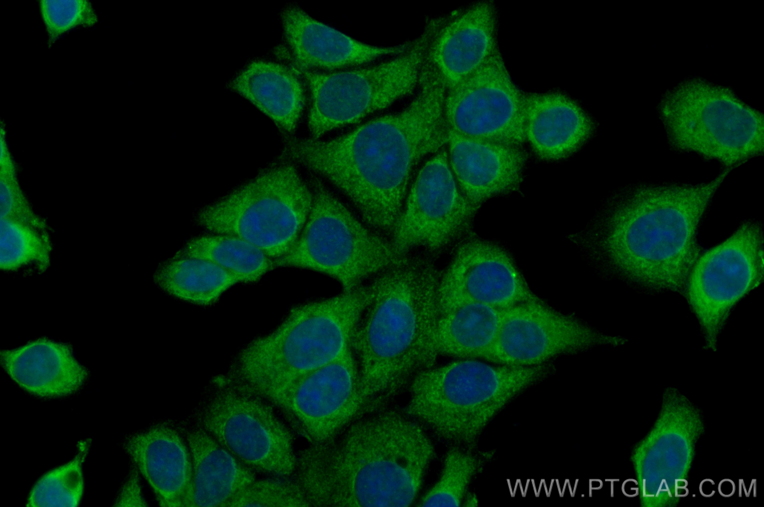 Immunofluorescence (IF) / fluorescent staining of MCF-7 cells using CoraLite® Plus 488-conjugated FRS2 Polyclonal anti (CL488-11503)