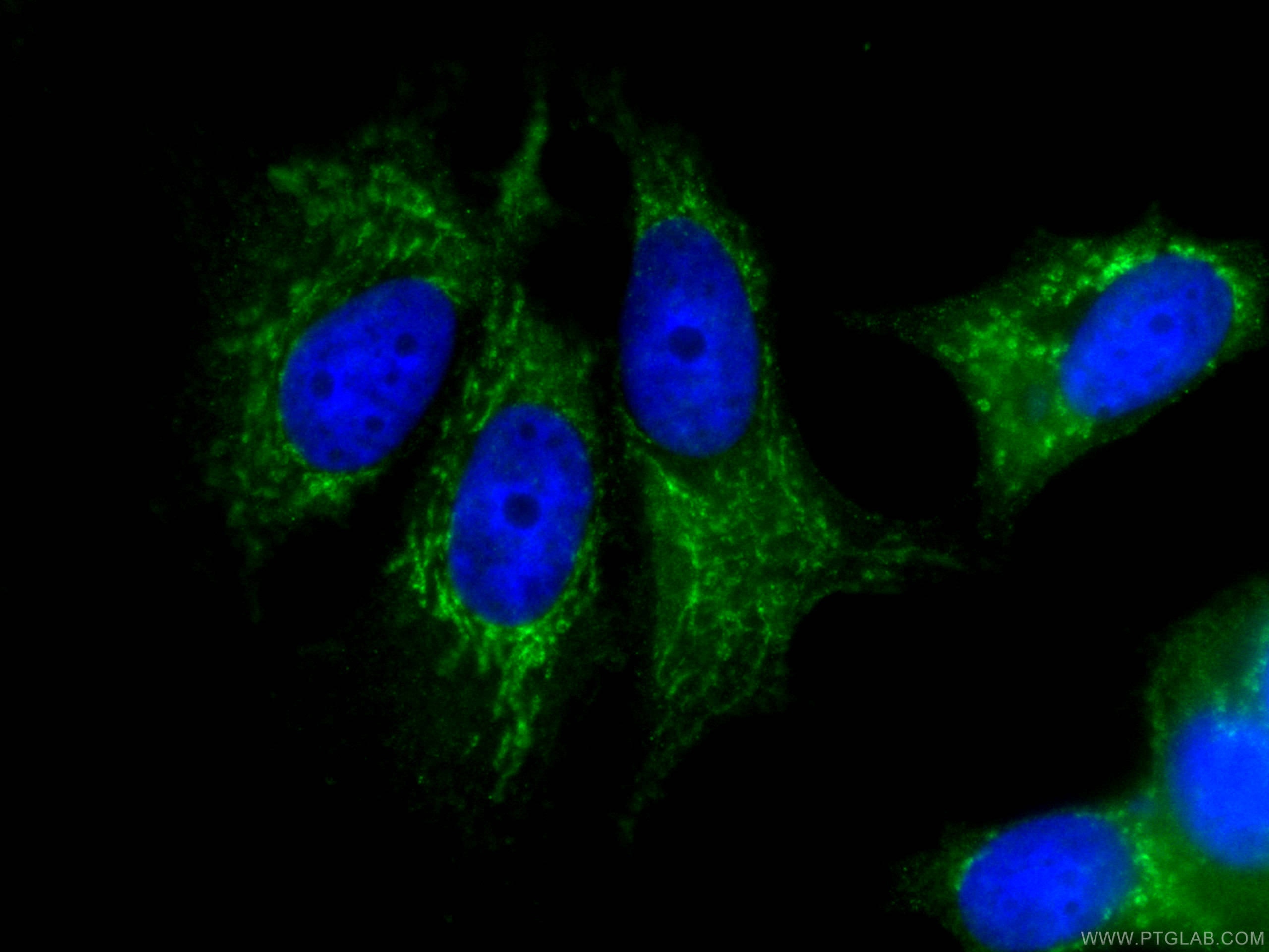 Immunofluorescence (IF) / fluorescent staining of MCF-7 cells using CoraLite® Plus 488-conjugated FRS2 Monoclonal anti (CL488-66263)