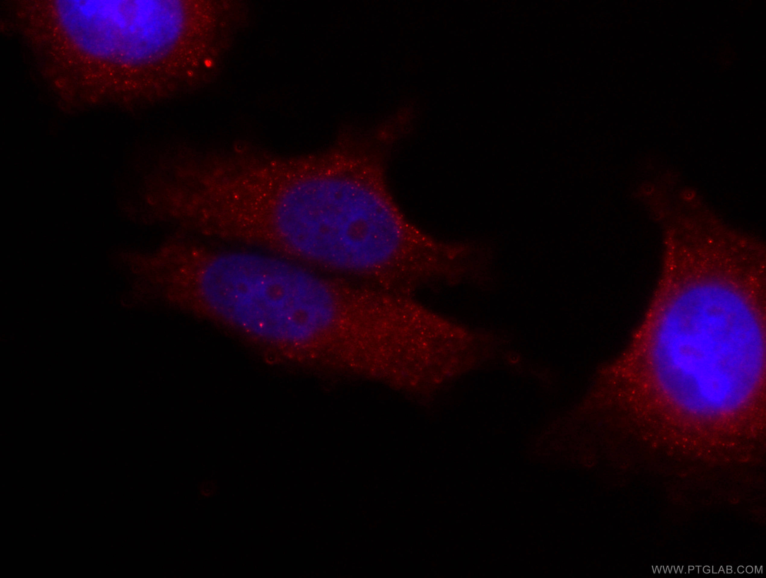 Immunofluorescence (IF) / fluorescent staining of MCF-7 cells using CoraLite®594-conjugated FRS2 Monoclonal antibody (CL594-66263)