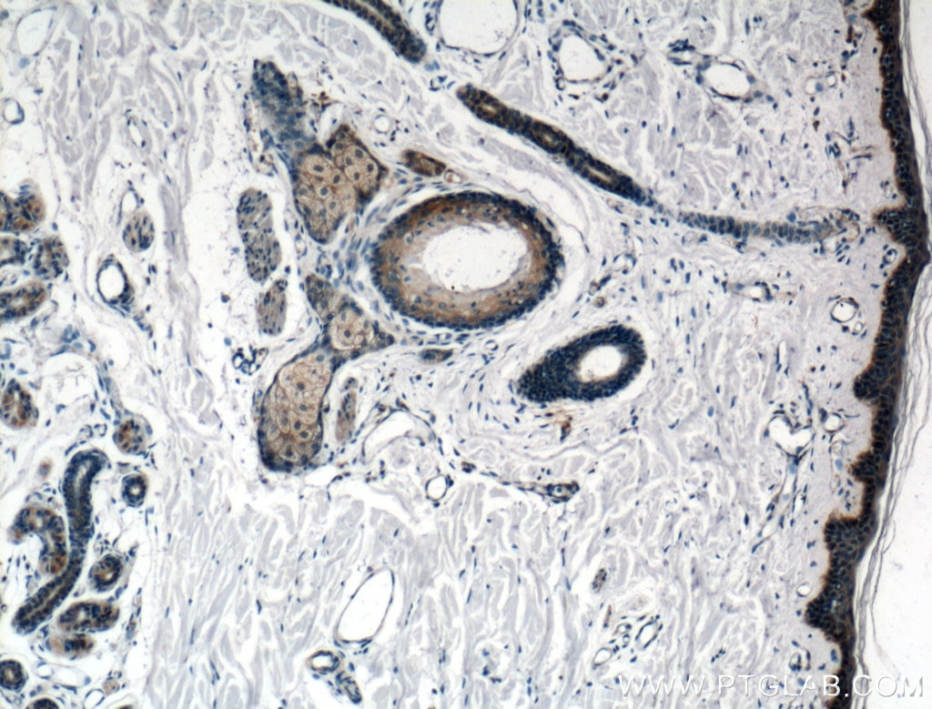 Immunohistochemistry (IHC) staining of human skin tissue using FRS3 Polyclonal antibody (12249-1-AP)