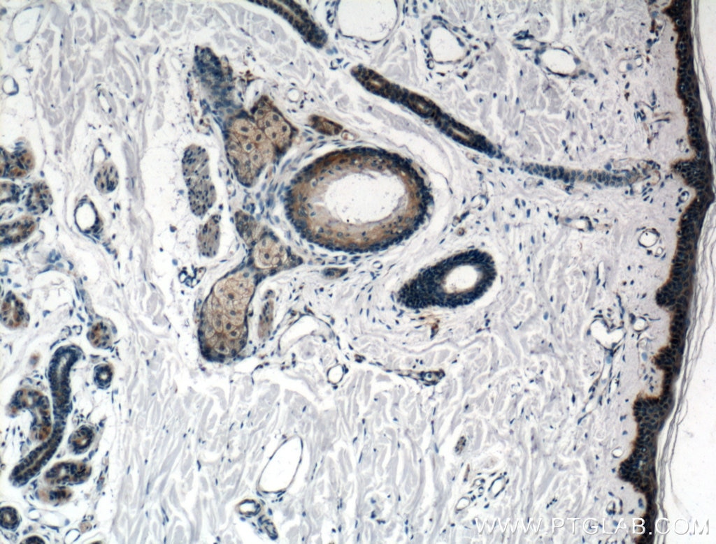 IHC staining of human skin using 12249-1-AP