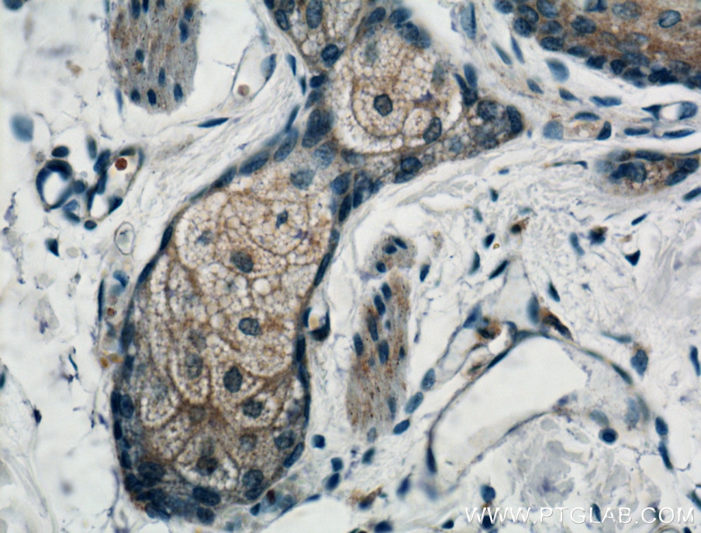 Immunohistochemistry (IHC) staining of human skin tissue using FRS3 Polyclonal antibody (12249-1-AP)